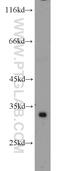 ATP Synthase F1 Subunit Gamma antibody, 10910-1-AP, Proteintech Group, Western Blot image 