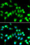 A-Kinase Anchoring Protein 5 antibody, 15-366, ProSci, Immunofluorescence image 