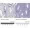 TBC1 Domain Family Member 21 antibody, NBP1-92479, Novus Biologicals, Immunohistochemistry paraffin image 
