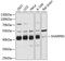 SHANK Associated RH Domain Interactor antibody, 14-330, ProSci, Western Blot image 