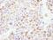 CRM1 antibody, A300-469A, Bethyl Labs, Immunohistochemistry paraffin image 