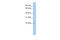 Tumor suppressor candidate gene 1 protein antibody, 26-860, ProSci, Western Blot image 