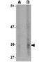 Endonuclease G antibody, GTX84985, GeneTex, Western Blot image 