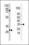 Snail Family Transcriptional Repressor 2 antibody, GTX82511, GeneTex, Western Blot image 