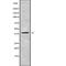 Radial Spoke Head 14 Homolog antibody, abx218401, Abbexa, Western Blot image 