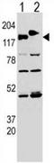 Cytoplasmic Linker Associated Protein 2 antibody, AP50937PU-N, Origene, Western Blot image 
