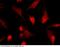 TSC22 Domain Family Member 1 antibody, 12724-R043, Sino Biological, Immunohistochemistry paraffin image 