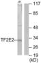 General Transcription Factor IIE Subunit 2 antibody, abx013454, Abbexa, Western Blot image 