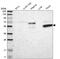 KH Domain Containing 4, Pre-MRNA Splicing Factor antibody, PA5-52612, Invitrogen Antibodies, Western Blot image 