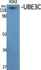 Ubiquitin-protein ligase E3C antibody, A06324, Boster Biological Technology, Western Blot image 