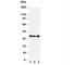 Aquaporin 4 antibody, R30323, NSJ Bioreagents, Western Blot image 