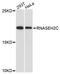 Ribonuclease H2 Subunit C antibody, A08750, Boster Biological Technology, Western Blot image 