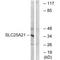 Solute Carrier Family 25 Member 21 antibody, A11791, Boster Biological Technology, Western Blot image 