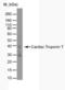 Troponin T2, Cardiac Type antibody, NB100-66490, Novus Biologicals, Western Blot image 