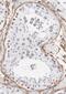 TIR domain-containing adapter molecule 2 antibody, FNab08687, FineTest, Immunohistochemistry paraffin image 