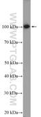 Protein Phosphatase 1 Regulatory Subunit 10 antibody, 24450-1-AP, Proteintech Group, Western Blot image 