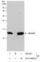 SEC61 Translocon Beta Subunit antibody, GTX129852, GeneTex, Immunoprecipitation image 
