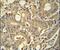 Tryptase Delta 1 antibody, PA5-24002, Invitrogen Antibodies, Immunohistochemistry frozen image 
