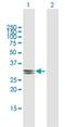 Enoyl-CoA Hydratase Domain Containing 2 antibody, H00055268-B01P, Novus Biologicals, Western Blot image 