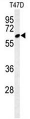 ClpB Homolog, Mitochondrial AAA ATPase Chaperonin antibody, AP50972PU-N, Origene, Western Blot image 