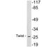 Twist Family BHLH Transcription Factor 1 antibody, LS-C200041, Lifespan Biosciences, Western Blot image 