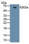 Glutamate Ionotropic Receptor AMPA Type Subunit 2 antibody, abx132421, Abbexa, Western Blot image 