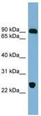 VPS53 Subunit Of GARP Complex antibody, TA344886, Origene, Western Blot image 