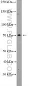 Acyl-CoA Synthetase Short Chain Family Member 3 antibody, 16204-1-AP, Proteintech Group, Western Blot image 