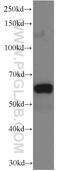 Eukaryotic Translation Initiation Factor 3 Subunit D antibody, 66024-1-Ig, Proteintech Group, Western Blot image 