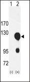 Receptor Tyrosine Kinase Like Orphan Receptor 2 antibody, LS-C99124, Lifespan Biosciences, Western Blot image 