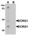 Transmembrane Serine Protease 11A antibody, LS-B9598, Lifespan Biosciences, Western Blot image 