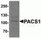 Phosphofurin Acidic Cluster Sorting Protein 1 antibody, NBP2-81695, Novus Biologicals, Western Blot image 