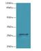 Transmembrane Protein 217 antibody, LS-C376853, Lifespan Biosciences, Western Blot image 