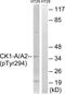 Casein Kinase 1 Alpha 1 antibody, LS-C198804, Lifespan Biosciences, Western Blot image 