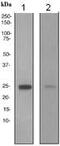 Retinol Binding Protein 4 antibody, ab109193, Abcam, Western Blot image 