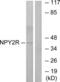 Neuropeptide Y Receptor Y2 antibody, LS-C120758, Lifespan Biosciences, Western Blot image 