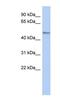 Myocardial Zonula Adherens Protein antibody, NBP1-56359, Novus Biologicals, Western Blot image 