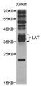 Linker For Activation Of T Cells antibody, MBS129947, MyBioSource, Western Blot image 