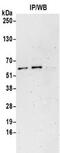 Gamma-Aminobutyric Acid Type A Receptor Alpha4 Subunit antibody, NBP2-32077, Novus Biologicals, Immunoprecipitation image 