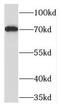 TOX High Mobility Group Box Family Member 2 antibody, FNab08877, FineTest, Western Blot image 