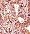 Cyclin Dependent Kinase 7 antibody, ab59987, Abcam, Immunohistochemistry paraffin image 