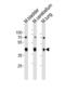 Cholecystokinin receptor type A antibody, abx034937, Abbexa, Western Blot image 