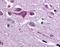 Solute Carrier Family 5 Member 9 antibody, orb86346, Biorbyt, Immunohistochemistry paraffin image 