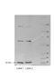 Regulator Of Calcineurin 1 antibody, 25-434, ProSci, Enzyme Linked Immunosorbent Assay image 