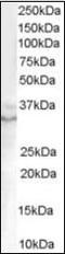 Growth Differentiation Factor 15 antibody, orb88189, Biorbyt, Western Blot image 