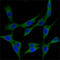 ST13 Hsp70 Interacting Protein antibody, M05692, Boster Biological Technology, Western Blot image 