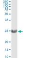 Beta-galactoside alpha-2,6-sialyltransferase 1 antibody, H00006480-M01, Novus Biologicals, Immunoprecipitation image 