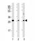 NK2 Homeobox 5 antibody, F53210-0.4ML, NSJ Bioreagents, Western Blot image 