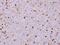 Rac GTPase-activating protein 1 antibody, PA5-22265, Invitrogen Antibodies, Immunohistochemistry paraffin image 