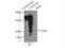 Transgelin 2 antibody, 15508-1-AP, Proteintech Group, Immunoprecipitation image 